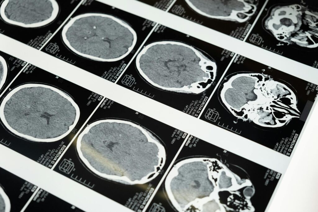 Des scans détaillés d'IRM cérébrale affichés sur une boîte lumineuse, mettant en valeur les techniques d'imagerie médicale.